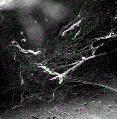 Raptus(Port.)-Antiphilanthropy/Fragments